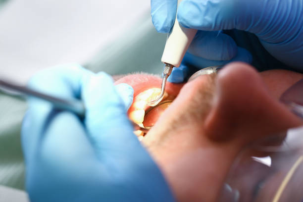 Best Broken or Chipped Tooth Repair in Richfield, MN